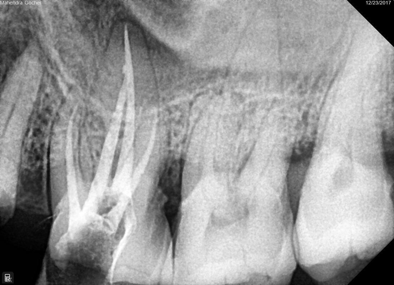 Dentist working